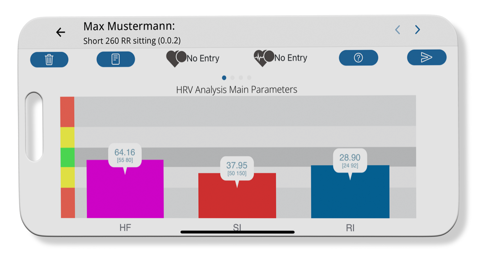 HRV Analyse - Dauerstress - Sympathikus erhöht